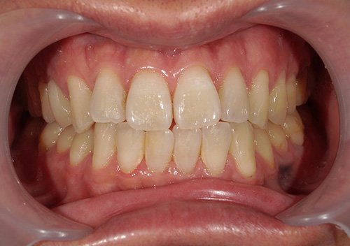 eclat　white