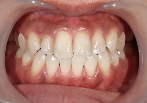 eclat　white